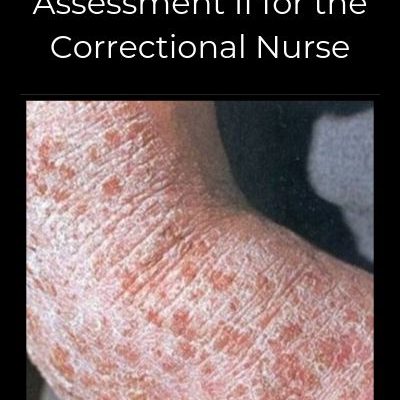 Correctional Nurse Clinical Update:  Skin Assessment II
