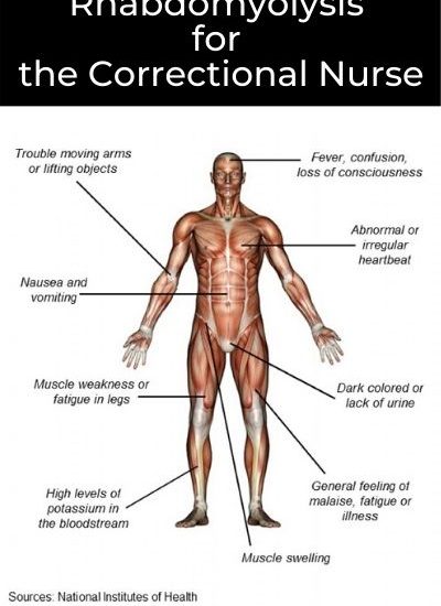 Rhabdomyolysis in Corrections