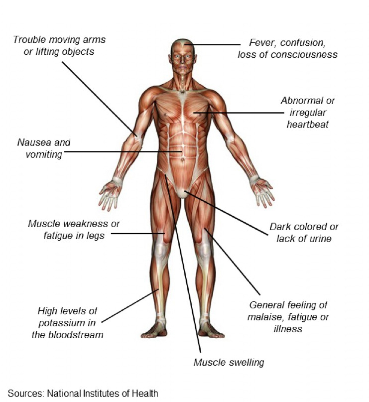 Rhabdomyolysis