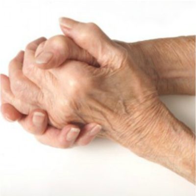 Correctional Nurse Clinical Update:  Rheumatoid Arthritis