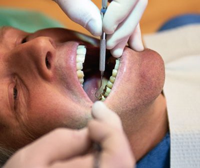 Correctional Nurse Clinical Update:  Dental Clues to Clinical Conditions